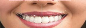 Zirkonyum Diş Estetiği Nedir? 