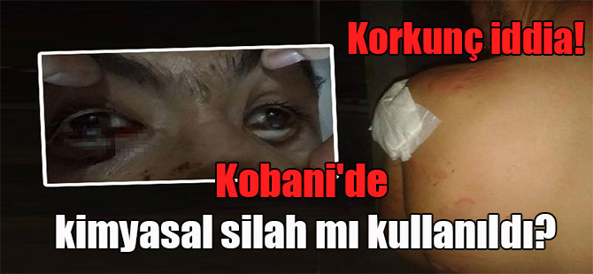 Kobani’de kimyasal silah mı kullanıldı? Korkunç iddia!