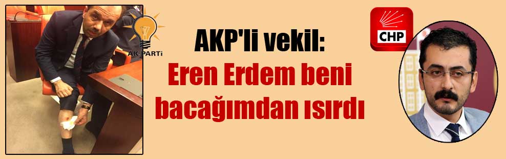 AKP’li vekil: Eren Erdem beni bacağımdan ısırdı