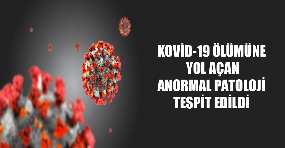 Kovid-19 ölümüne yol açan anormal patoloji tespit edildi