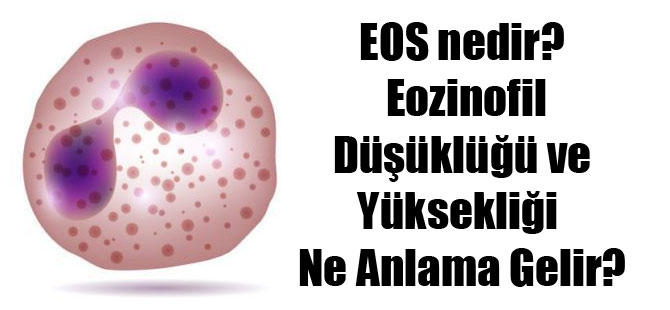 EOS nedir? Eozinofil Düşüklüğü ve Yüksekliği Ne Anlama Gelir?