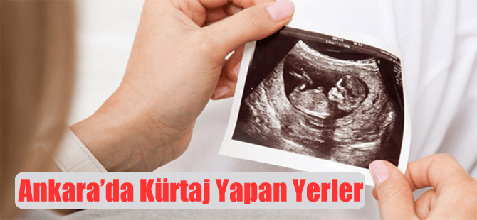 Ankara’da Kürtaj Yapan Yerler