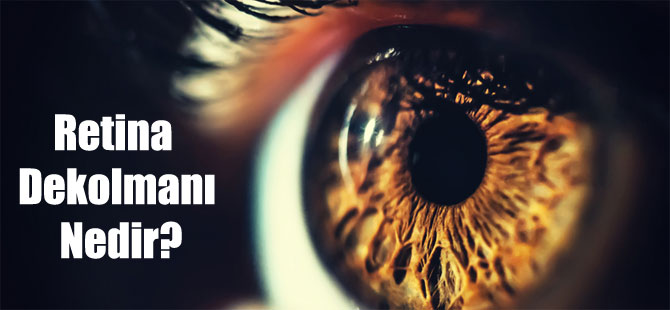 Retina Dekolmanı Nedir?