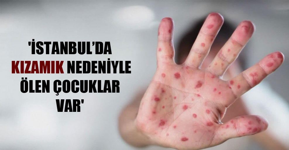 ‘İstanbul’da kızamık nedeniyle ölen çocuklar var’