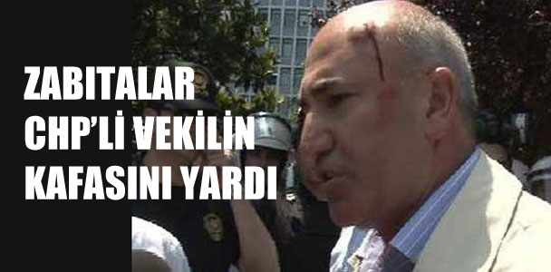 İstanbul'da CHP'li vekilin kafası yarıldı