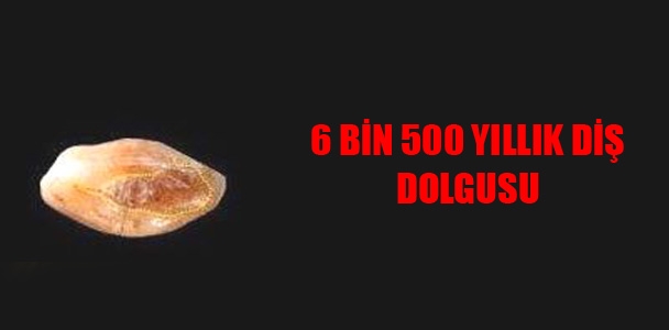 6 bin 500 yıllık diş dolgusu